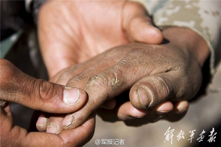 Jóvenes soldados en tierra de nadie