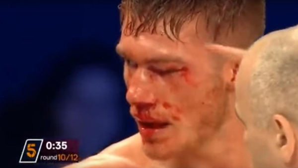 El boxeador Nick Blackwell, en coma inducido tras un combate