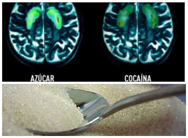 El azúcar puede provocar los mismos efectos que la cocaína